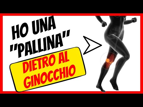 Ciste di baker si può camminare
