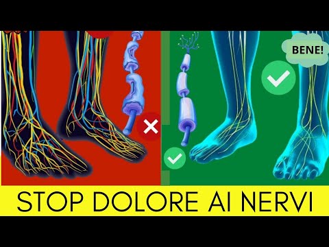 Nervi del piede che tirano