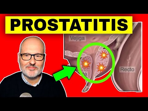Prostatite passa da sola